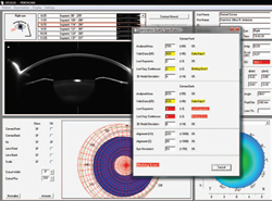 Figure 2: Pentacam overview display