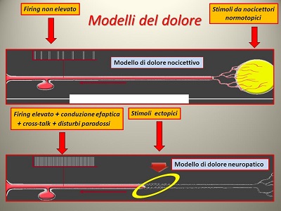 Il dolore della regione orbitaria di origine non bulbare