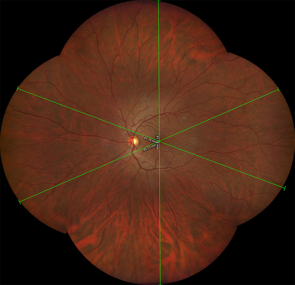 Portale di Oculistica - Casi Reali