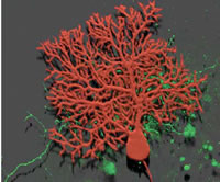 Cellula del Purkinje del cervelletto