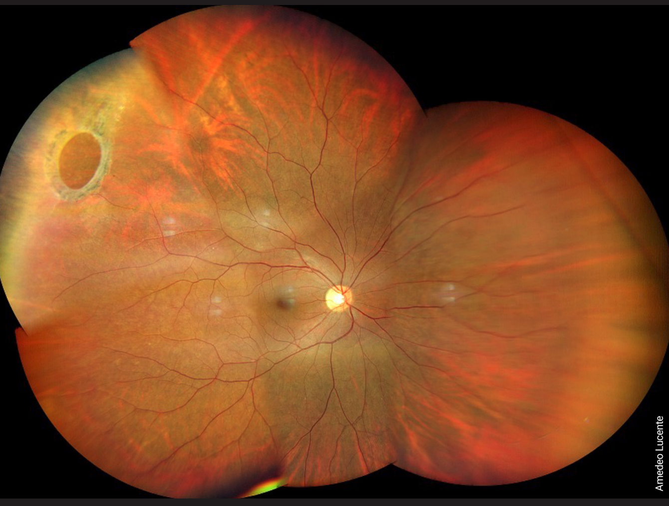 Portale di Oculistica - Patologie Oculari